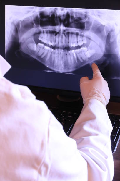 Best Emergency Tooth Extraction in Arial, SC