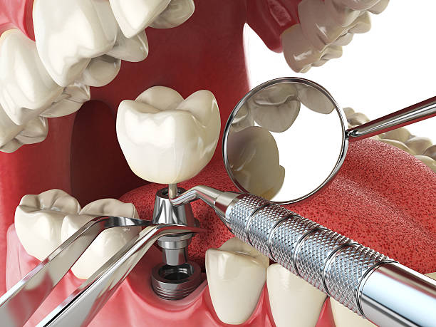 Best Weekend Emergency Dentist in Arial, SC